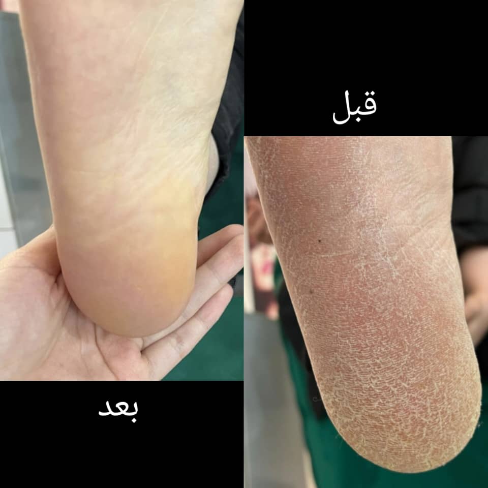 پدیکور