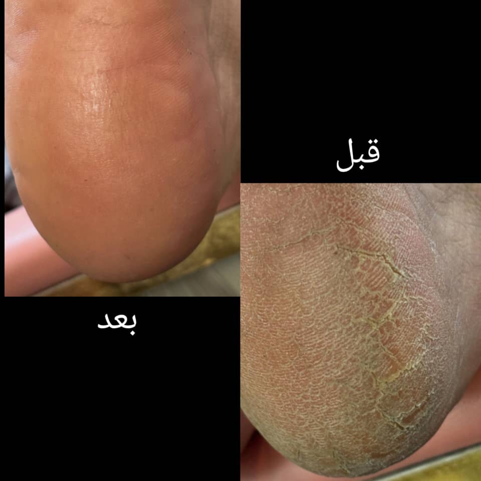 پدیکور