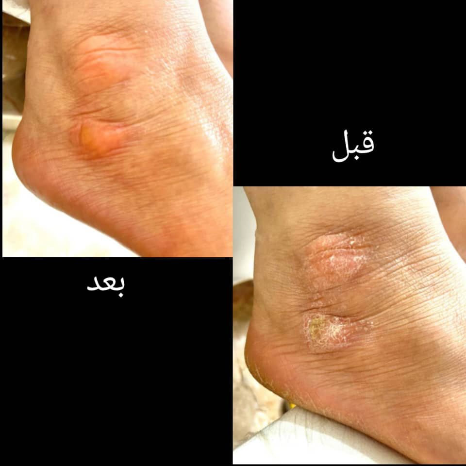 پدیکور