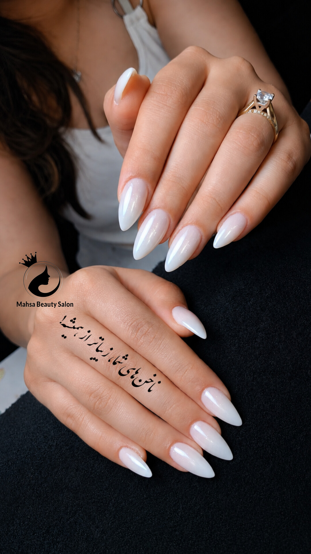 کاشت ناخن